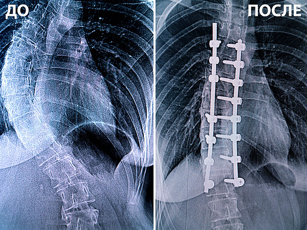 ��-�����. 